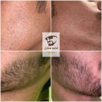 زيت اللحيه والشنب - Image 3
